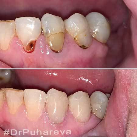 Работы стоматолога DrPuhareva