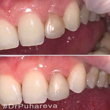 Работы стоматолога DrPuhareva