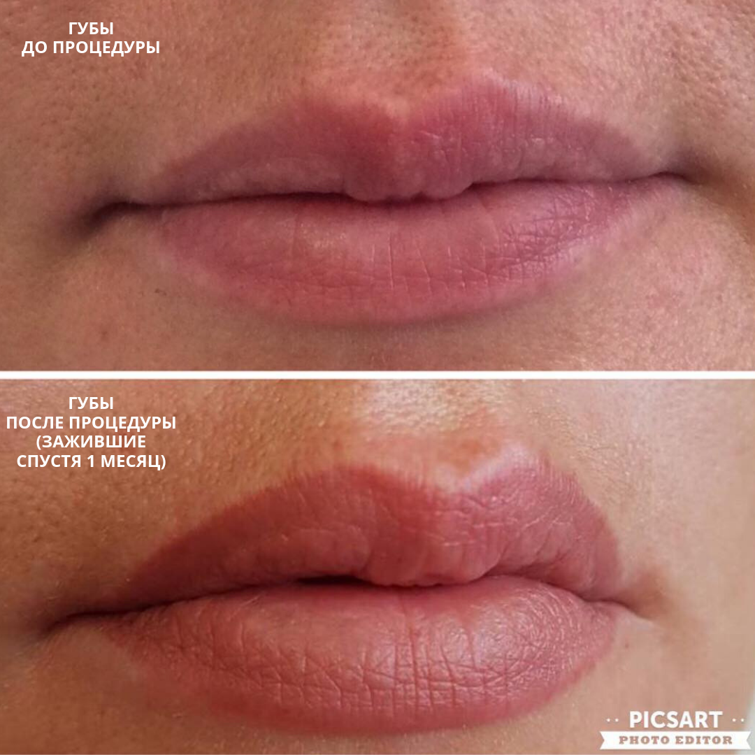 Перманентный макияж губ фото после заживления таблица